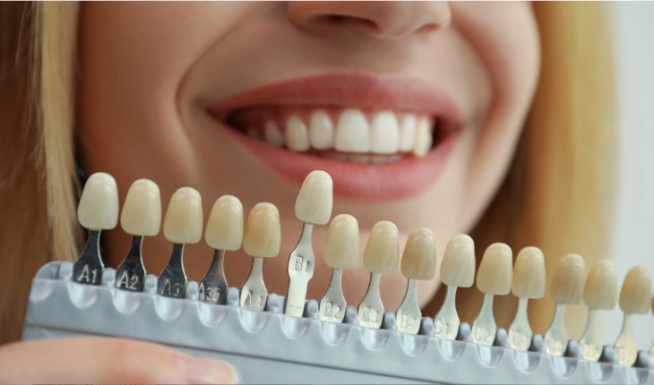How to Choose the Right Cosmetic Dental Treatment for Your Smile
