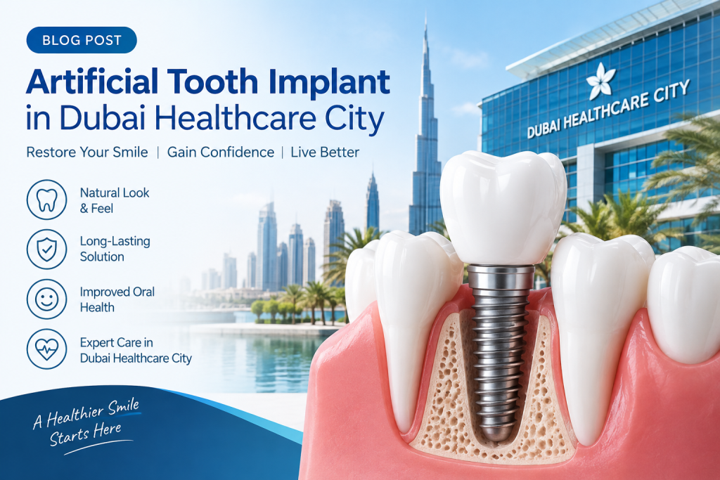 Artificial Tooth Implant in Dubai Healthcare City